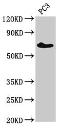 ICK Antibody - Western Blot Positive WB detected in: PC-3 whole cell lysate All lanes: ICK antibody at 3µg/ml Secondary Goat polyclonal to rabbit IgG at 1/50000 dilution Predicted band size: 72, 35 kDa Observed band size: 72 kDa