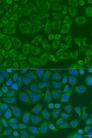 ICK Antibody - Immunofluorescence analysis of U2OS cells using ICK Polyclonal Antibody at dilution of 1:100.Blue: DAPI for nuclear staining.