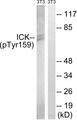 ICK Antibody - Western blot analysis of lysates from NIH/3T3 cells treated with starved 24h, using ICK (Phospho-Tyr159) Antibody. The lane on the right is blocked with the phospho peptide.