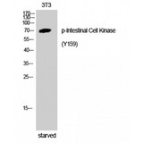 ICK Antibody - Western blot of Phospho-Intestinal Cell Kinase (Y159) antibody
