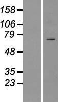 ICK Protein - Western validation with an anti-DDK antibody * L: Control HEK293 lysate R: Over-expression lysate