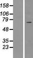 ICK Protein - Western validation with an anti-DDK antibody * L: Control HEK293 lysate R: Over-expression lysate