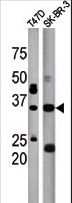 ICMT / PPMT Antibody - The anti-ICMT antibody is used in Western blot to detect ICMT in T47D (left) and SK-BR-3 (right) tissue lysate