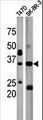 ICMT / PPMT Antibody - The anti-ICMT antibody is used in Western blot to detect ICMT in T47D (left) and SK-BR-3 (right) tissue lysate