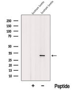 ICMT / PPMT Antibody - Western blot analysis of extracts of C6 cells using ICMT antibody. The lane on the left was treated with blocking peptide.