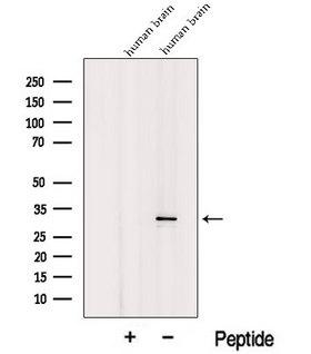 ICMT / PPMT Antibody - Western blot analysis of extracts of C6 cells using ICMT antibody. The lane on the left was treated with blocking peptide.