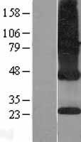 ICMT / PPMT Protein - Western validation with an anti-DDK antibody * L: Control HEK293 lysate R: Over-expression lysate