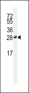 ICOS / CD278 Antibody - ICOS-S171 western blot of Jurkat cell line lysates (35 ug/lane). The ICOS antibody detected the ICOS protein (arrow).