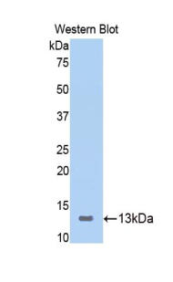 ICOS / CD278 Antibody - Western blot of recombinant ICOS.  This image was taken for the unconjugated form of this product. Other forms have not been tested.