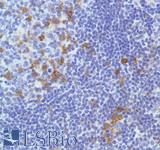 ICOS / CD278 Antibody - Immunohistochemistry of Human Reactive Lymph Node stained with anti-CD278/ICOS antibody