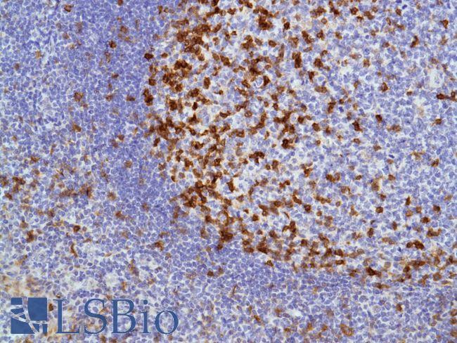ICOS / CD278 Antibody - Immunohistochemistry of Human Tonsil stained with anti-CD278/ICOS antibody