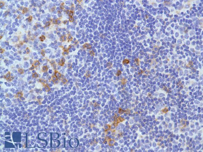 ICOS / CD278 Antibody - Immunohistochemistry of Human Reactive Lymph Node stained with anti-CD278/ICOS antibody