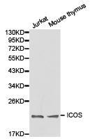 ICOS / CD278 Antibody - Western blot of extracts of various cell lines, using ICOS antibody.