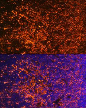 ICOS / CD278 Antibody - Immunofluorescence analysis of Mouse thymus using ICOS Polyclonal Antibody at dilution of 1:100.Blue: DAPI for nuclear staining.