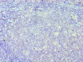 ICSBP / IRF8 Antibody - Immunohistochemistry of paraffin-embedded human tonsil tissue using IRF8 Antibody at dilution of 1:100