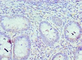 ICSBP / IRF8 Antibody - Immunohistochemistry of paraffin-embedded human epityphlon using antibody at 1:100 dilution.