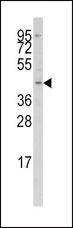 ICSBP / IRF8 Antibody - Western blot of anti-IRF8 Antibody in Jurkat cell line lysates (35 ug/lane). IRF8 (arrow) was detected using the purified antibody.
