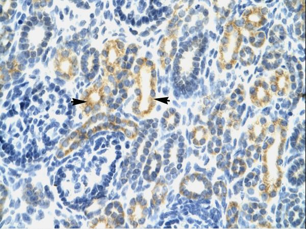 ICSBP / IRF8 Antibody - IRF8 antibody P100841_T100-NP_002154-IRF8 (interferon regulatory factor 8) Antibody was used in IHC to stain formalin-fixed, paraffin-embedded human kidney.  This image was taken for the unconjugated form of this product. Other forms have not been tested.