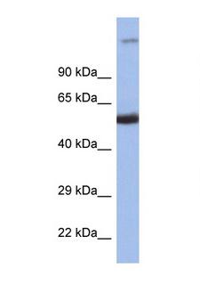 ICSBP / IRF8 Antibody - IRF8 antibody Western blot of 1 Cell lysate. Antibody concentration 1 ug/ml.  This image was taken for the unconjugated form of this product. Other forms have not been tested.