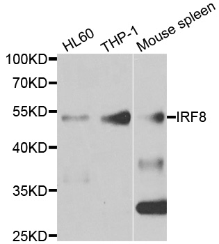 ICSBP / IRF8 Antibody - Western blot analysis of extracts of various cell lines.