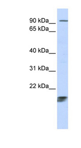 ICT1 / DS1 Antibody - ICT1 antibody Western blot of Fetal thymus lysate. This image was taken for the unconjugated form of this product. Other forms have not been tested.