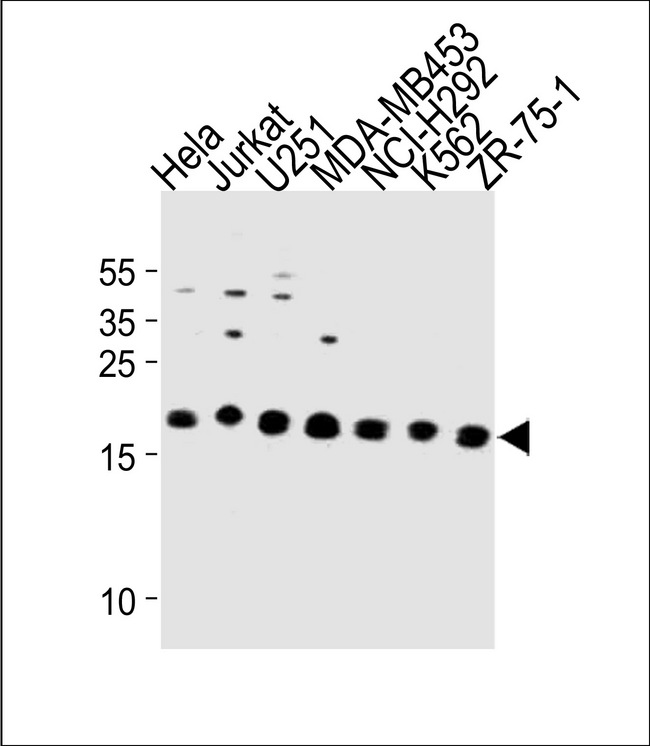 ICT1 / DS1 Antibody - ICT1 Antibody western blot of HeLa,Jurkat,U251,MDA-MB453,NCI-H292,K562,ZR-75-1 cell line lysates (35 ug/lane). The ICT1 antibody detected the ICT1 protein (arrow).