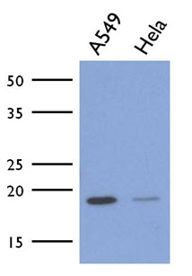 ICT1 / DS1 Antibody - Western Blot: The cell lysates (40 ug) were resolved by SDS-PAGE, transferred to PVDF membrane and probed with anti-human ICT1 antibody (1:1000). Proteins were visualized using a goat anti-mouse secondary antibody conjugated to HRP and an ECL detection system.