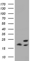 ICT1 / DS1 Antibody - HEK293T cells were transfected with the pCMV6-ENTRY control (Left lane) or pCMV6-ENTRY ICT1 (Right lane) cDNA for 48 hrs and lysed. Equivalent amounts of cell lysates (5 ug per lane) were separated by SDS-PAGE and immunoblotted with anti-ICT1.
