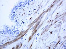 ICT1 / DS1 Antibody - IHC of paraffin-embedded Human prostate tissue using anti-ICT1 mouse monoclonal antibody. (Heat-induced epitope retrieval by 10mM citric buffer, pH6.0, 120°C for 3min).