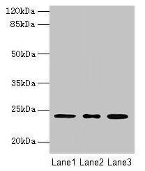 ICT1 / DS1 Antibody - Western blot All lanes: Peptidyl-tRNA hydrolase ICT1, mitochondrial antibody at 2µg/ml Lane 1: A549 whole cell lysate Lane 2: K562 whole cell lysate Secondary Goat polyclonal to rabbit IgG at 1/10000 dilution Predicted band size: 24 kDa Observed band size: 24 kDa