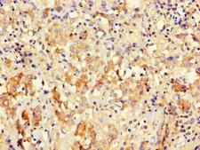 ICT1 / DS1 Antibody - Immunohistochemistry of paraffin-embedded human lung tissue using MRPL58 Antibody at dilution of 1:100
