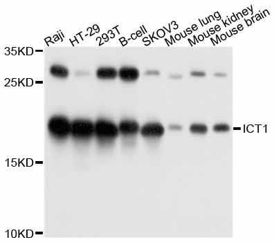 ICT1 / DS1 Antibody - Western blot analysis of extracts of various cell lines, using ICT1 antibody at 1:1000 dilution. The secondary antibody used was an HRP Goat Anti-Rabbit IgG (H+L) at 1:10000 dilution. Lysates were loaded 25ug per lane and 3% nonfat dry milk in TBST was used for blocking. An ECL Kit was used for detection and the exposure time was 5s.