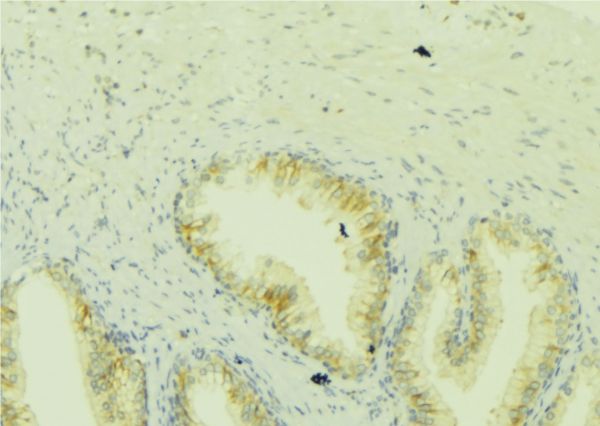 ICT1 / DS1 Antibody - 1:100 staining mouse colon tissue by IHC-P. The sample was formaldehyde fixed and a heat mediated antigen retrieval step in citrate buffer was performed. The sample was then blocked and incubated with the antibody for 1.5 hours at 22°C. An HRP conjugated goat anti-rabbit antibody was used as the secondary.