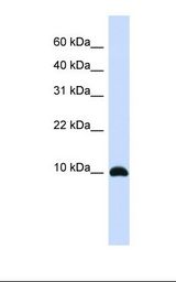 ID / ID1 Antibody - Fetal brain lysate. Antibody concentration: 1.0 ug/ml. Gel concentration: 10-20%.  This image was taken for the unconjugated form of this product. Other forms have not been tested.