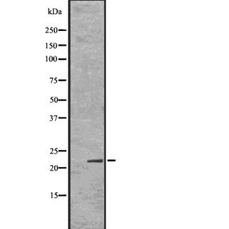 ID / ID1 Antibody - Western blot analysis Id1 using Jurkat whole cells lysates