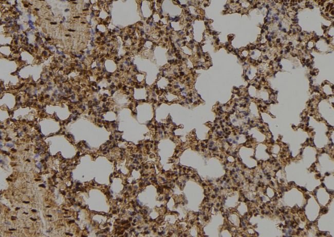 ID / ID1 Antibody - 1:100 staining mouse lung tissue by IHC-P. The sample was formaldehyde fixed and a heat mediated antigen retrieval step in citrate buffer was performed. The sample was then blocked and incubated with the antibody for 1.5 hours at 22°C. An HRP conjugated goat anti-rabbit antibody was used as the secondary.