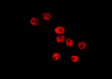 ID / ID1 Antibody - Staining HeLa cells by IF/ICC. The samples were fixed with PFA and permeabilized in 0.1% Triton X-100, then blocked in 10% serum for 45 min at 25°C. The primary antibody was diluted at 1:200 and incubated with the sample for 1 hour at 37°C. An Alexa Fluor 594 conjugated goat anti-rabbit IgG (H+L) Ab, diluted at 1/600, was used as the secondary antibody.