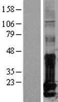 ID / ID1 Protein - Western validation with an anti-DDK antibody * L: Control HEK293 lysate R: Over-expression lysate