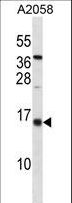 ID3 Antibody - ID3 Antibody western blot of A2058 cell line lysates (35 ug/lane). The ID3 Antibody detected the ID3 protein (arrow).
