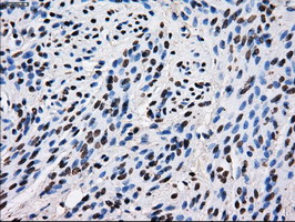 ID3 Antibody - IHC of paraffin-embedded endometrium tissue using anti-ID3 mouse monoclonal antibody. (Dilution 1:50).