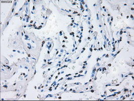 ID3 Antibody - IHC of paraffin-embedded lung tissue using anti-ID3 mouse monoclonal antibody. (Dilution 1:50).
