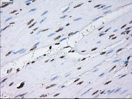 ID3 Antibody - IHC of paraffin-embedded bladder tissue using anti-ID3 mouse monoclonal antibody. (Dilution 1:50).