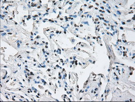 ID3 Antibody - IHC of paraffin-embedded lung tissue using anti-ID3 mouse monoclonal antibody. (Dilution 1:50).