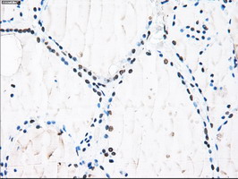 ID3 Antibody - IHC of paraffin-embedded thyroid tissue using anti-ID3 mouse monoclonal antibody. (Dilution 1:50).