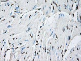 ID3 Antibody - IHC of paraffin-embedded bladder tissue using anti-ID3 mouse monoclonal antibody. (Dilution 1:50).