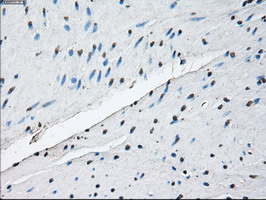 ID3 Antibody - IHC of paraffin-embedded colon tissue using anti-ID3 mouse monoclonal antibody. (Dilution 1:50).