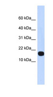 ID4 Antibody - ID4 antibody Western blot of 293T cell lysate. This image was taken for the unconjugated form of this product. Other forms have not been tested.