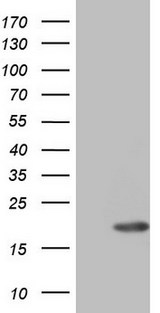 ID4 Antibody - HEK293T cells were transfected with the pCMV6-ENTRY control (Left lane) or pCMV6-ENTRY ID4 (Right lane) cDNA for 48 hrs and lysed. Equivalent amounts of cell lysates (5 ug per lane) were separated by SDS-PAGE and immunoblotted with anti-ID4.