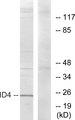 ID4 Antibody - Western blot analysis of extracts from HepG2 cells, using ID4 antibody.
