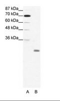 ID4 Antibody - A: Marker, B: HepG2 Cell Lysate.  This image was taken for the unconjugated form of this product. Other forms have not been tested.